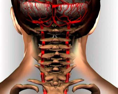 Симптомы остеохондроза шейного отдела
