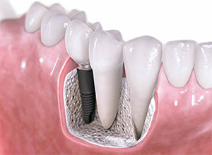 Что делает стоматолог-ортопед и чем занимается?